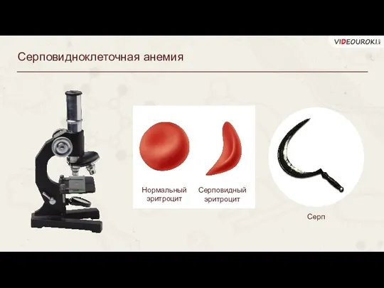 Серповидноклеточная анемия Нормальный эритроцит Серповидный эритроцит Серп