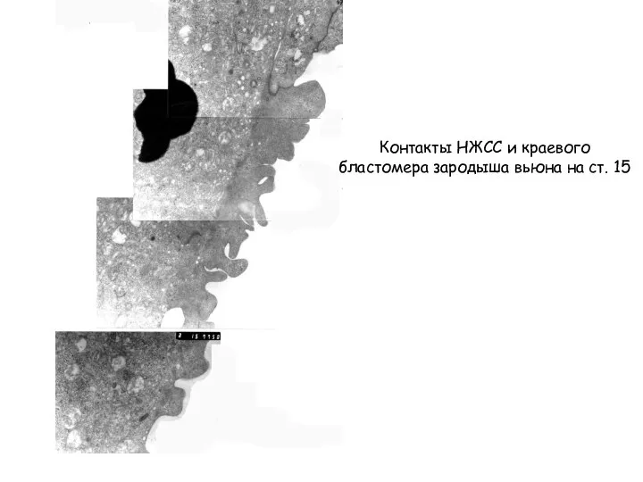 Контакты НЖСС и краевого бластомера зародыша вьюна на ст. 15