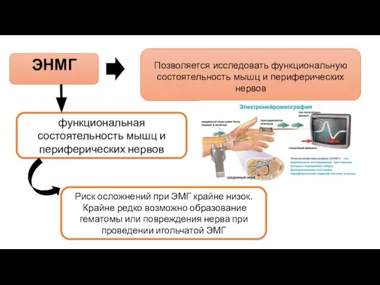 ЭНМГ Позволяется исследовать функциональную состоятельность мышц и периферических нервов функциональная состоятельность мышц