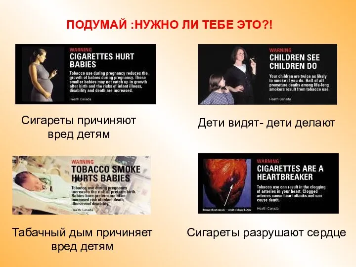 ПОДУМАЙ :НУЖНО ЛИ ТЕБЕ ЭТО?! Сигареты причиняют вред детям Табачный дым причиняет