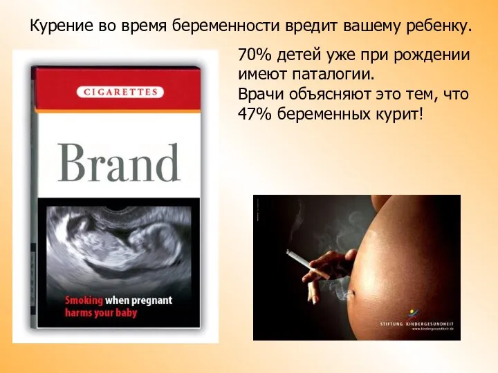 Курение во время беременности вредит вашему ребенку. 70% детей уже при рождении