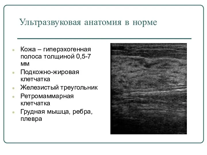 Ультразвуковая анатомия в норме Кожа – гиперэхогенная полоса толщиной 0,5-7 мм Подкожно-жировая