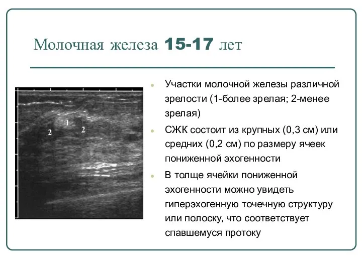 Молочная железа 15-17 лет Участки молочной железы различной зрелости (1-более зрелая; 2-менее