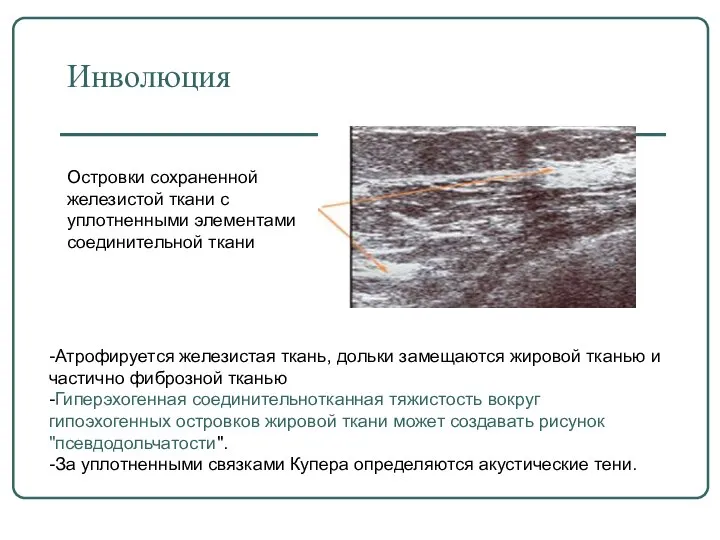 Инволюция Островки сохраненной железистой ткани с уплотненными элементами соединительной ткани -Атрофируется железистая