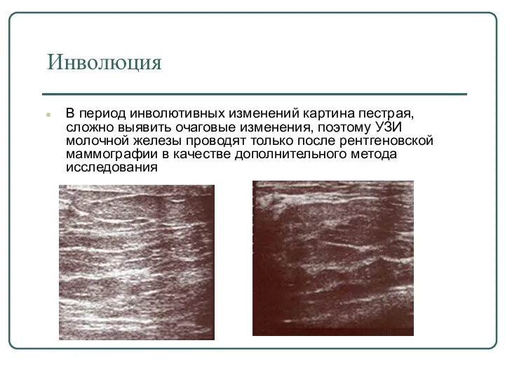 Инволюция В период инволютивных изменений картина пестрая, сложно выявить очаговые изменения, поэтому