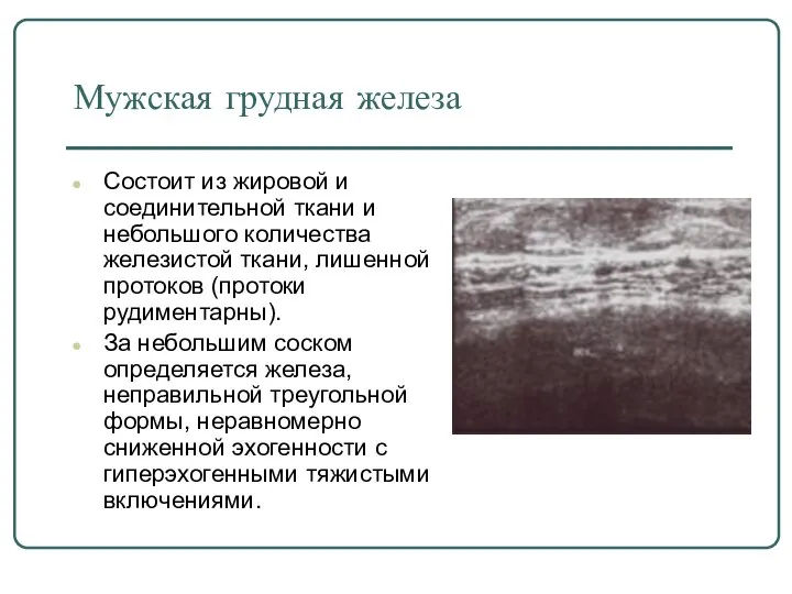 Мужская грудная железа Состоит из жировой и соединительной ткани и небольшого количества