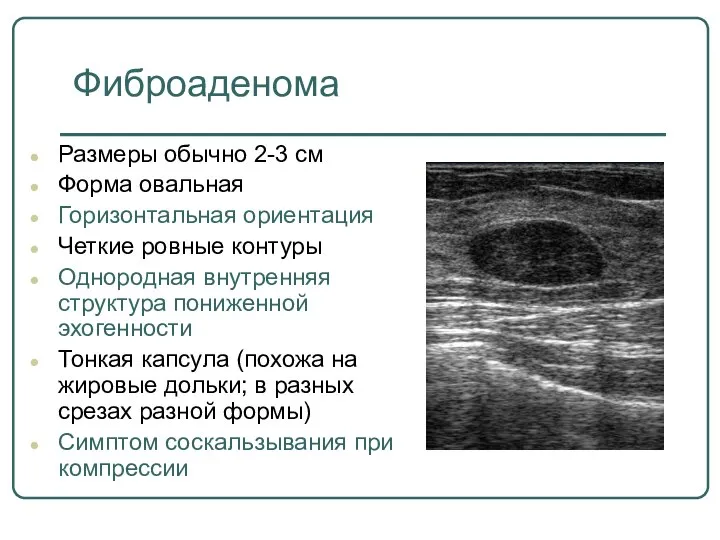 Размеры обычно 2-3 см Форма овальная Горизонтальная ориентация Четкие ровные контуры Однородная