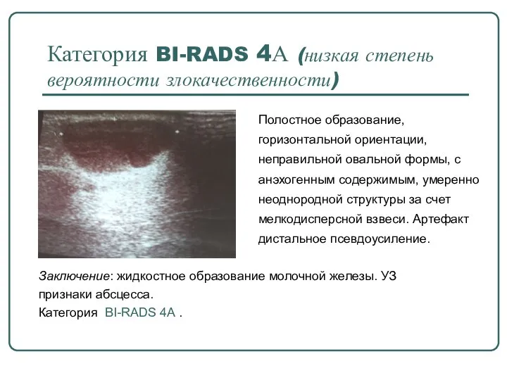 Категория BI-RADS 4А (низкая степень вероятности злокачественности) Полостное образование, горизонтальной ориентации, неправильной