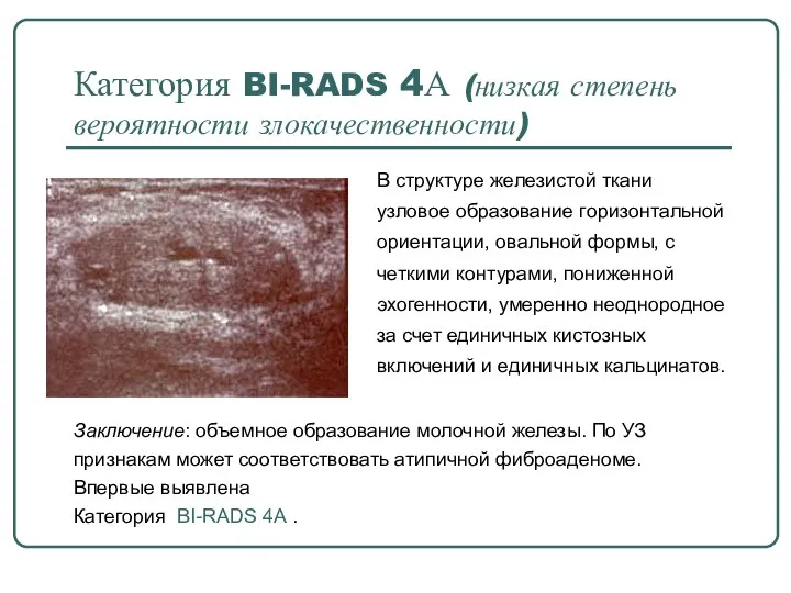Категория BI-RADS 4А (низкая степень вероятности злокачественности) В структуре железистой ткани узловое