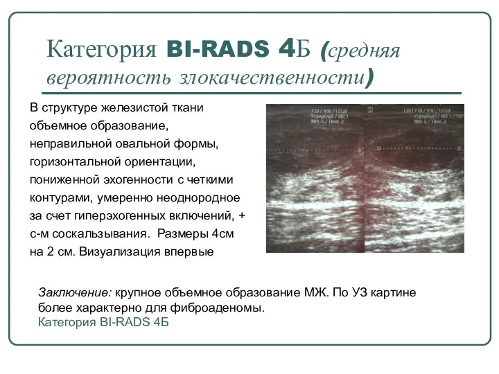 Категория BI-RADS 4Б (средняя вероятность злокачественности) В структуре железистой ткани объемное образование,