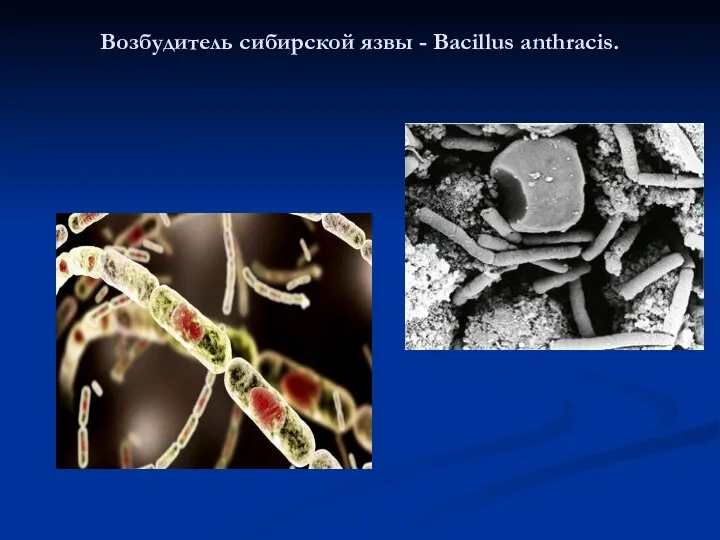 Возбудитель сибирской язвы - Bacillus anthracis.