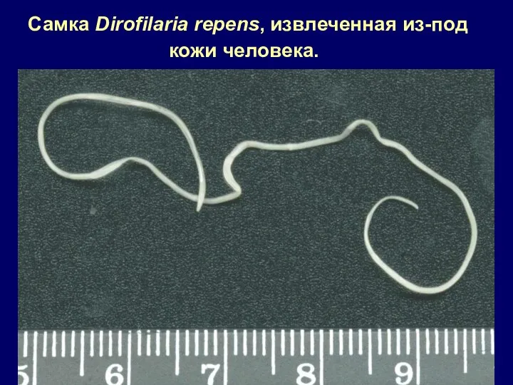 Самка Dirofilaria repens, извлеченная из-под кожи человека.