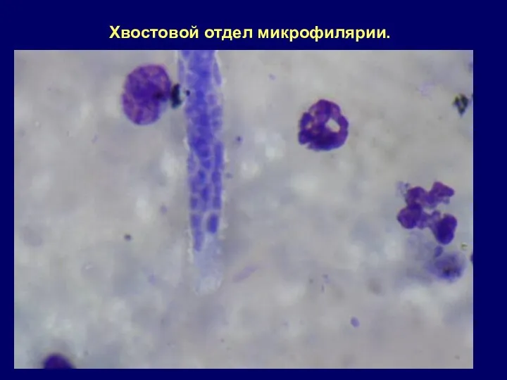 Хвостовой отдел микрофилярии.