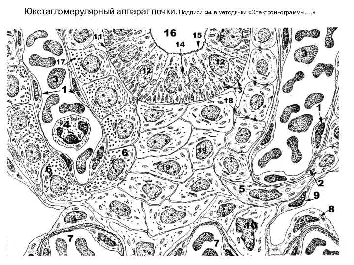 Юкстагломерулярный аппарат почки. Подписи см. в методички «Электроннограммы….»