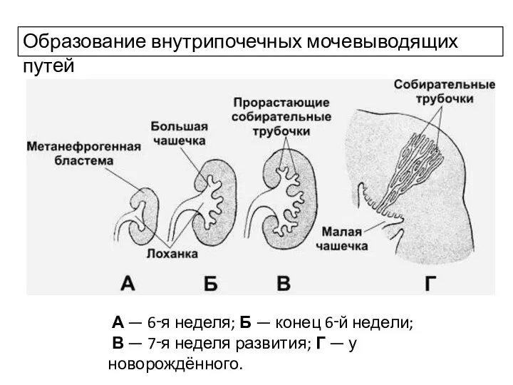 Образование внутрипочечных мочевыводящих путей А — 6‑я неделя; Б — конец 6‑й