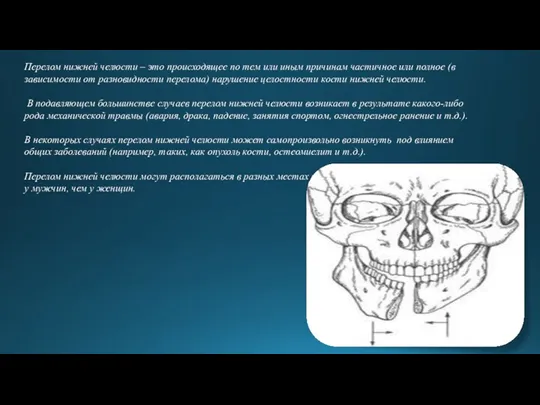 Перелом нижней челюсти – это происходящее по тем или иным причинам частичное