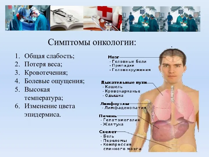 Симптомы онкологии: Общая слабость; Потеря веса; Кровотечения; Болевые ощущения; Высокая температура; Изменение цвета эпидермиса.