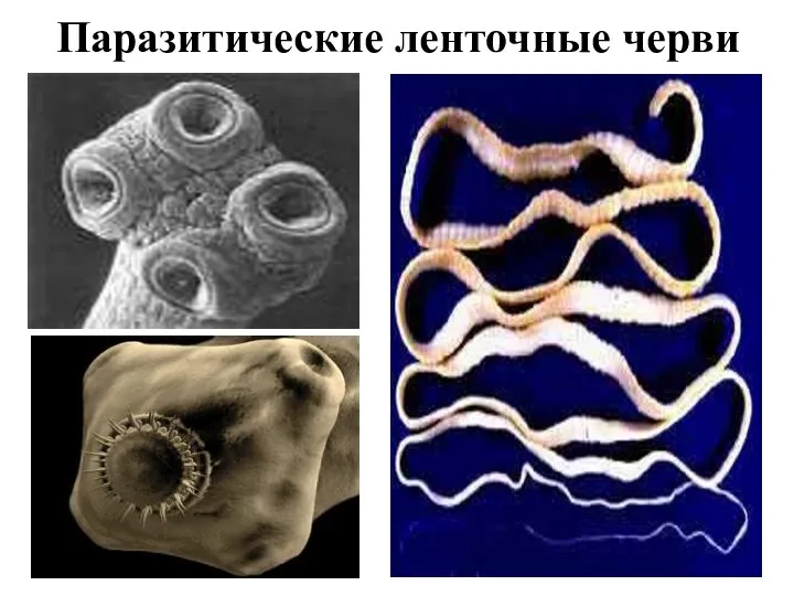 Паразитические ленточные черви