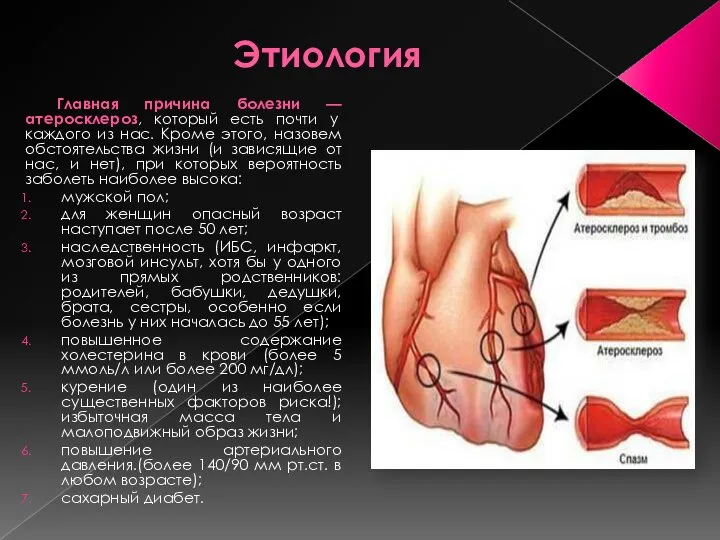 Этиология Главная причина болезни — атеросклероз, который есть почти у каждого из