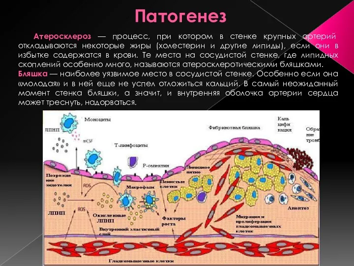 Патогенез Атеросклероз — процесс, при котором в стенке крупных артерий откладываются некоторые