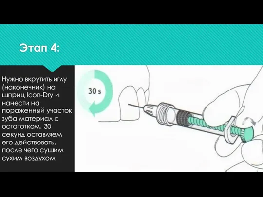 Этап 4: Нужно вкрутить иглу (наконечник) на шприц Icon-Dry и нанести на