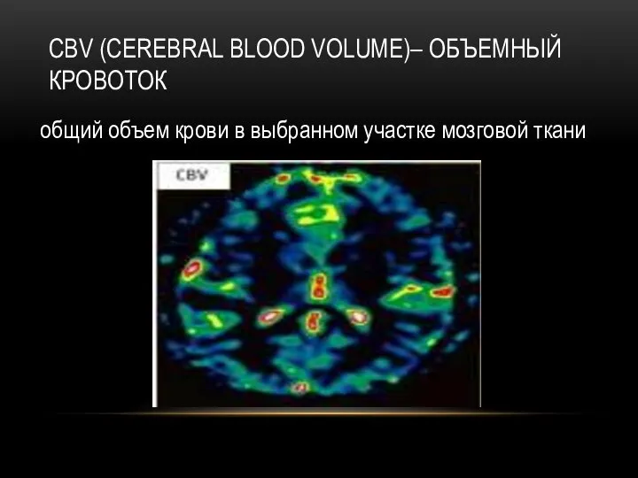 CBV (CEREBRAL BLOOD VOLUME)– ОБЪЕМНЫЙ КРОВОТОК общий объем крови в выбранном участке мозговой ткани