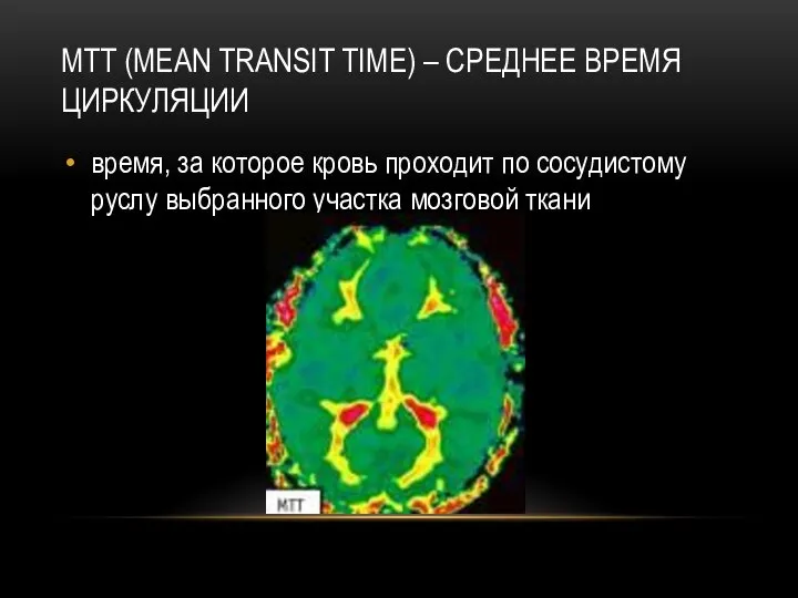 MTT (MEAN TRANSIT TIME) – СРЕДНЕЕ ВРЕМЯ ЦИРКУЛЯЦИИ время, за которое кровь