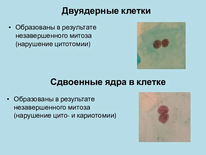 Сдвоенные ядра в клетке Образованы в результате незавершенного митоза (нарушение цитотомии) Двуядерные