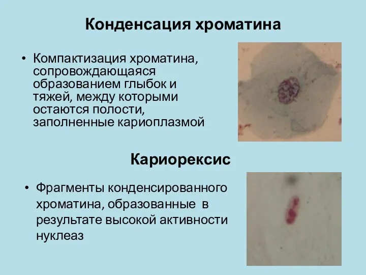 Конденсация хроматина Компактизация хроматина, сопровождающаяся образованием глыбок и тяжей, между которыми остаются