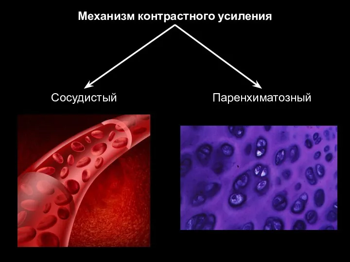 Механизм контрастного усиления Паренхиматозный Сосудистый