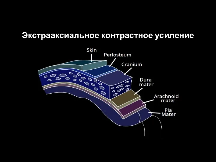 Экстрааксиальное контрастное усиление