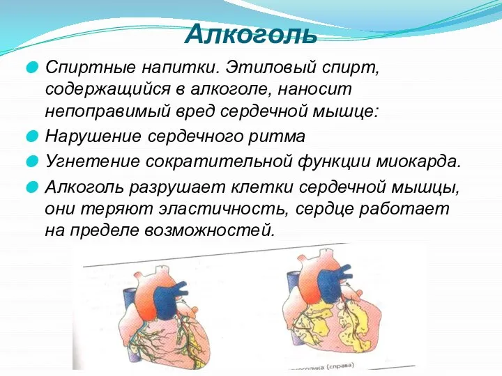 Алкоголь Спиртные напитки. Этиловый спирт, содержащийся в алкоголе, наносит непоправимый вред сердечной