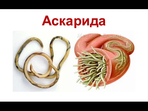 Аскарида