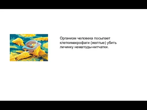 Организм человека посылает клеткимакрофаги (желтые) убить личинку нематоды-нитчатки.