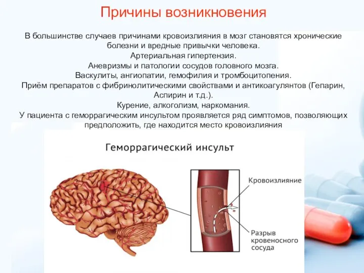 Причины возникновения В большинстве случаев причинами кровоизлияния в мозг становятся хронические болезни