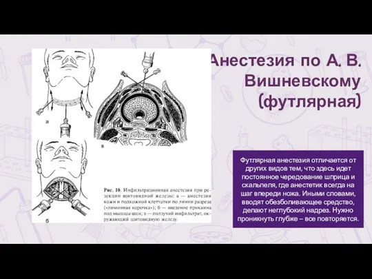 Анестезия по А. В. Вишневскому (футлярная) Футлярная анестезия отличается от других видов