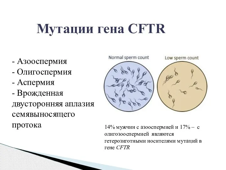 Мутации гена CFTR - Азооспермия - Олигоспермия - Аспермия - Врожденная двусторонняя