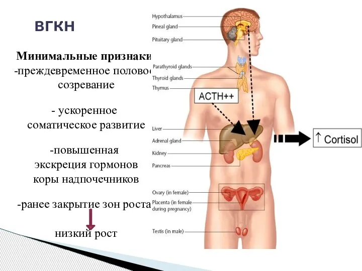 Минимальные признаки: преждевременное половое созревание ускоренное соматическое развитие повышенная экскреция гормонов коры