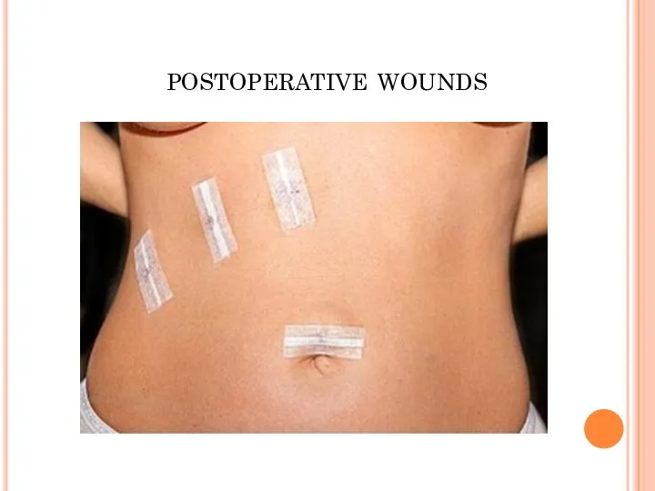 postoperative wounds