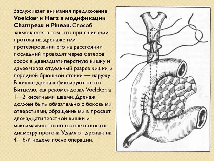 Заслуживает внимания предложение Voelcker и Herz в модификации Champeau и Pineau. Способ