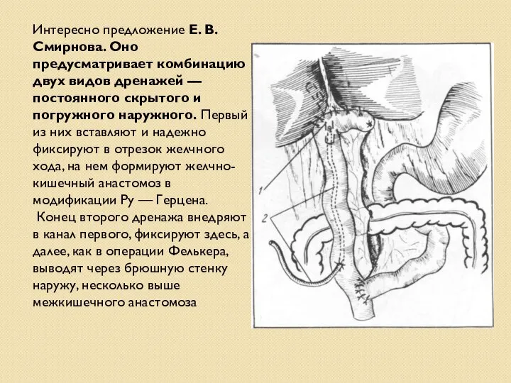 Интересно предложение Е. В. Смирнова. Оно предусматривает комбинацию двух видов дренажей —