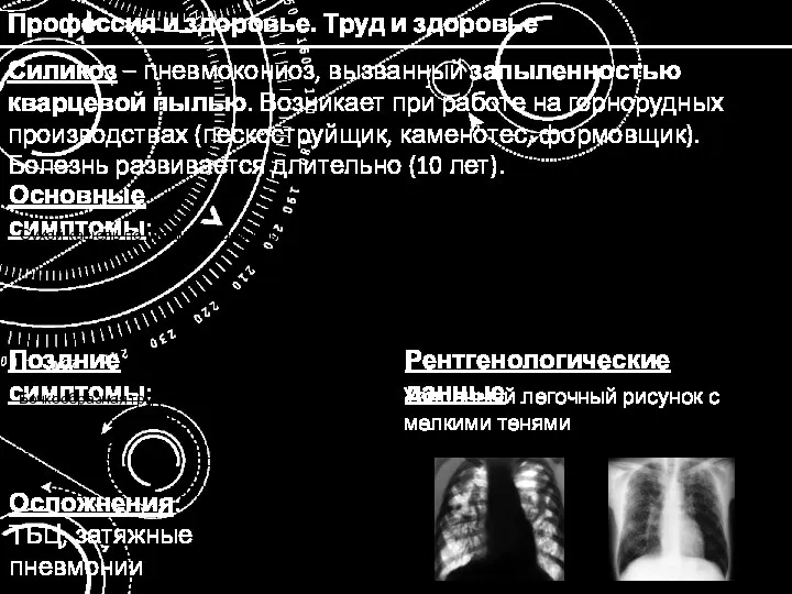 Профессия и здоровье. Труд и здоровье Силикоз – пневмокониоз, вызванный запыленностью кварцевой