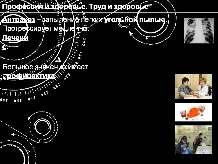 Профессия и здоровье. Труд и здоровье Антракоз – запыление легких угольной пылью.