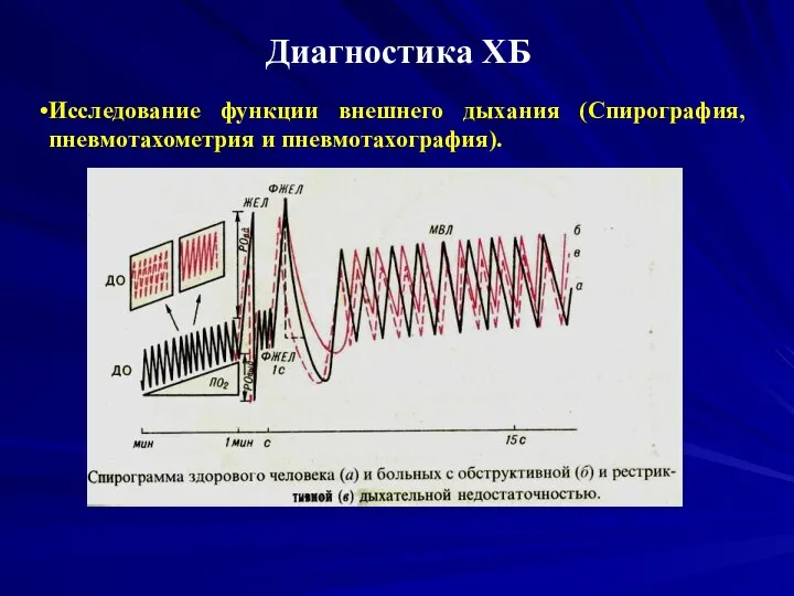 Диагностика ХБ Исследование функции внешнего дыхания (Спирография, пневмотахометрия и пневмотахография).