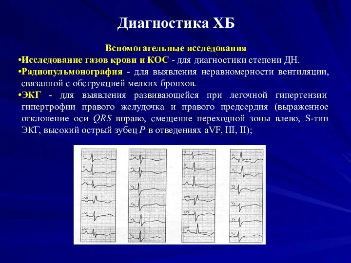 Диагностика ХБ Вспомогательные исследования Исследование газов крови и КОС - для диагностики