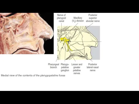 Medial view of the contents of the pterygopalatine fossa