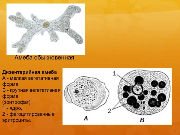 Амеба обыкновенная Дизентерийная амеба А - мелкая вегетативная форма, Б - крупная