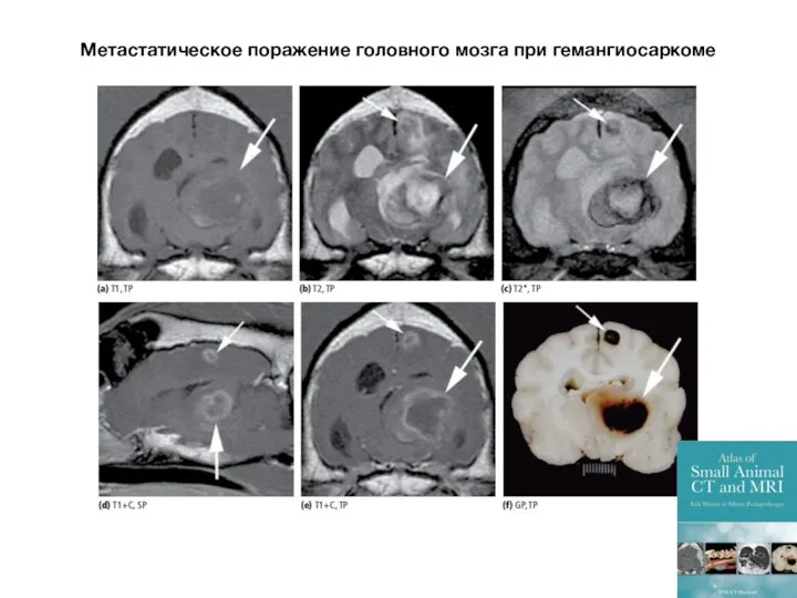 Метастатическое поражение головного мозга при гемангиосаркоме