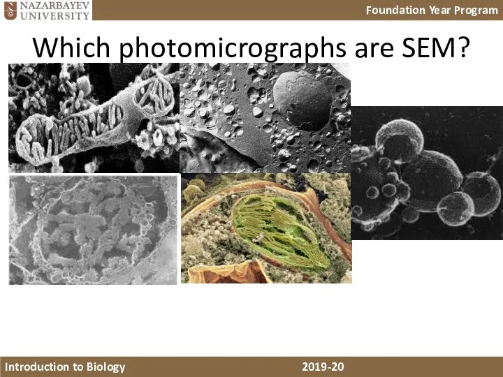 Which photomicrographs are SEM?
