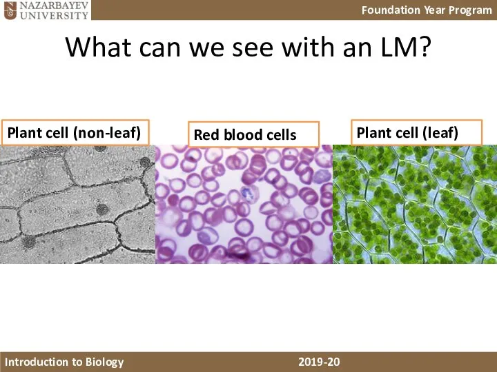 What can we see with an LM? Plant cell (non-leaf) Red blood cells Plant cell (leaf)